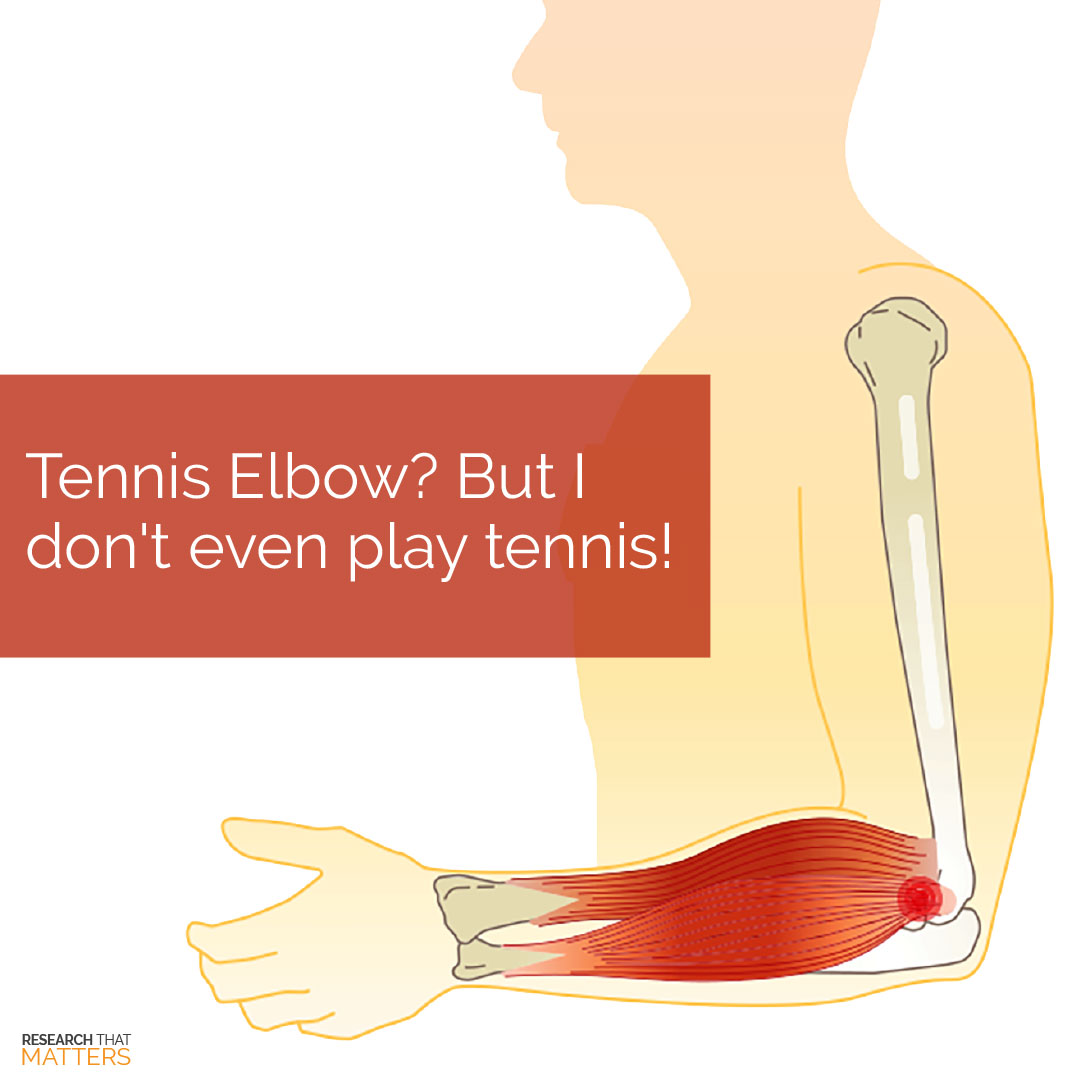 Read more about the article Tennis Elbow – But I Don’t Even Play Tennis!